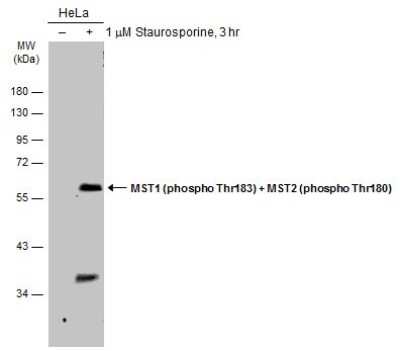 Western Blot: MST1/2 [p Thr180] Antibody [NBP3-13317] - Untreated (-) and treated (+) HeLa whole cell extracts (30 ug) were separated by 10% SDS-PAGE, and the membrane was blotted with MST1 (phospho Thr183) + MST2 (phospho Thr180) antibody (NBP3-13317) diluted at 1:500. The HRP-conjugated anti-rabbit IgG antibody (NBP2-19301) was used to detect the primary antibody, and the signal was developed with Trident ECL plus-Enhanced.